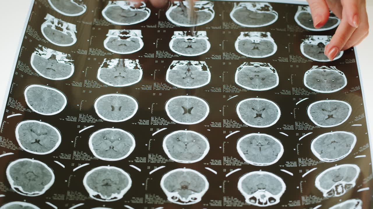 Hands examining a brain medical scan