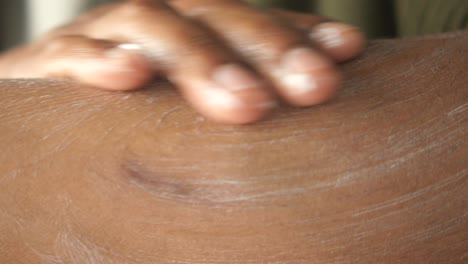 applying lotion to the skin