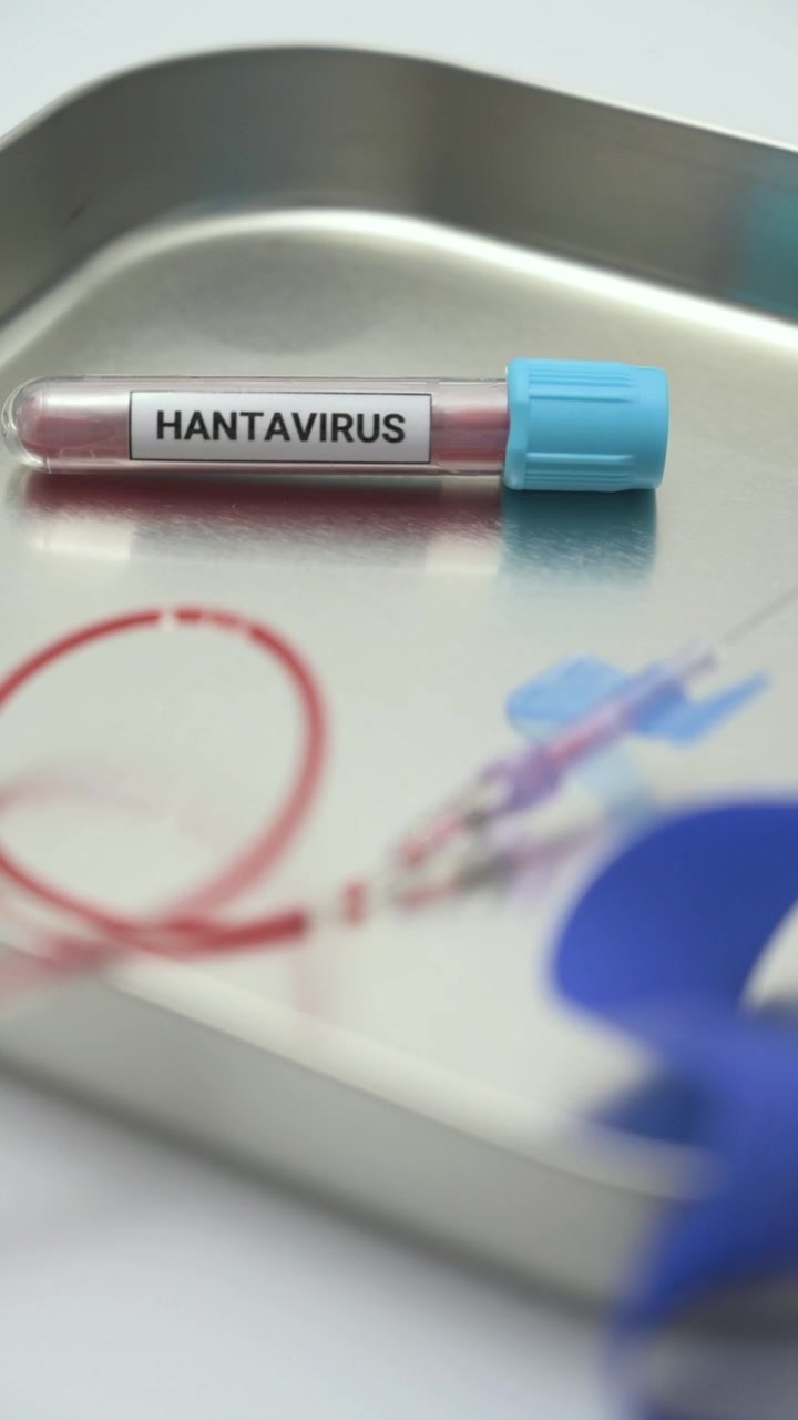 Laboratory technician placing a hantavirus blood sample on a stainless steel tray