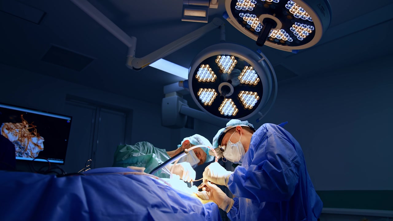 Medici eseguono neurochirurgia sotto le lampade rotonde. Monitor con scansione CTA 3D sullo sfondo.