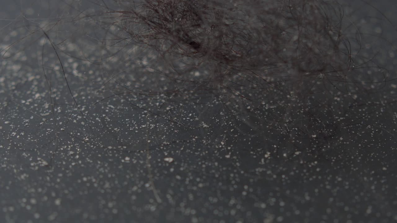 Close-up view of hair and dust on a dark gray surface