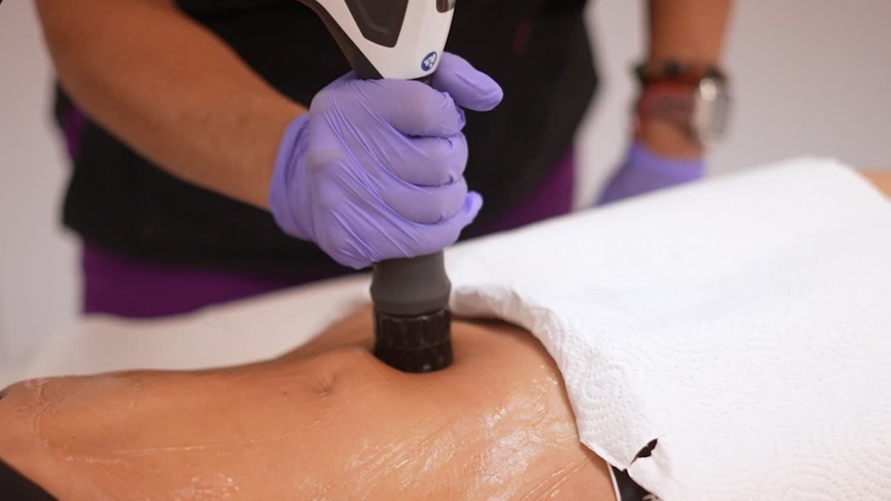 masaje de abdominoplastia, clínica estética, scultp fit, masaje de abdominoplastia, después de la cirugía, máquina de abdominoplastia, masaje, aparato estético, clínica cosmética