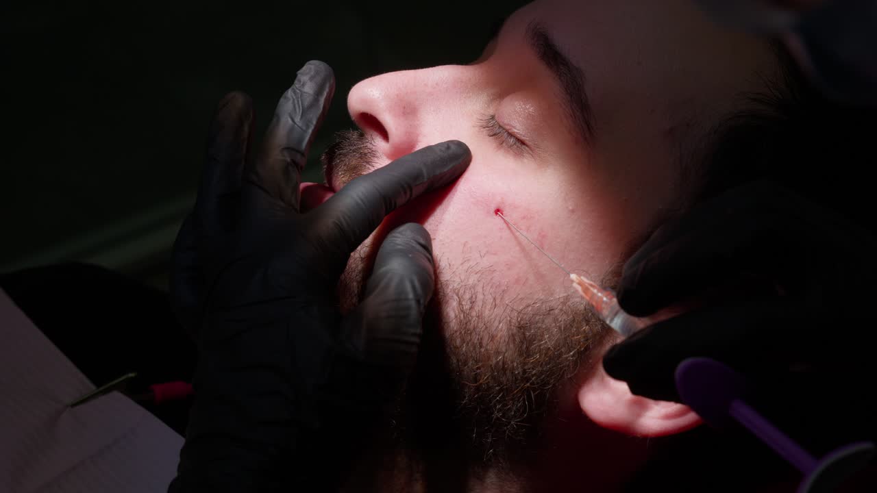 Primo piano di un uomo che riceve un'iniezione cosmetica sul viso