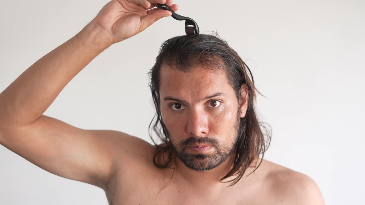 Man Using a Dermaroller for Hair Treatment