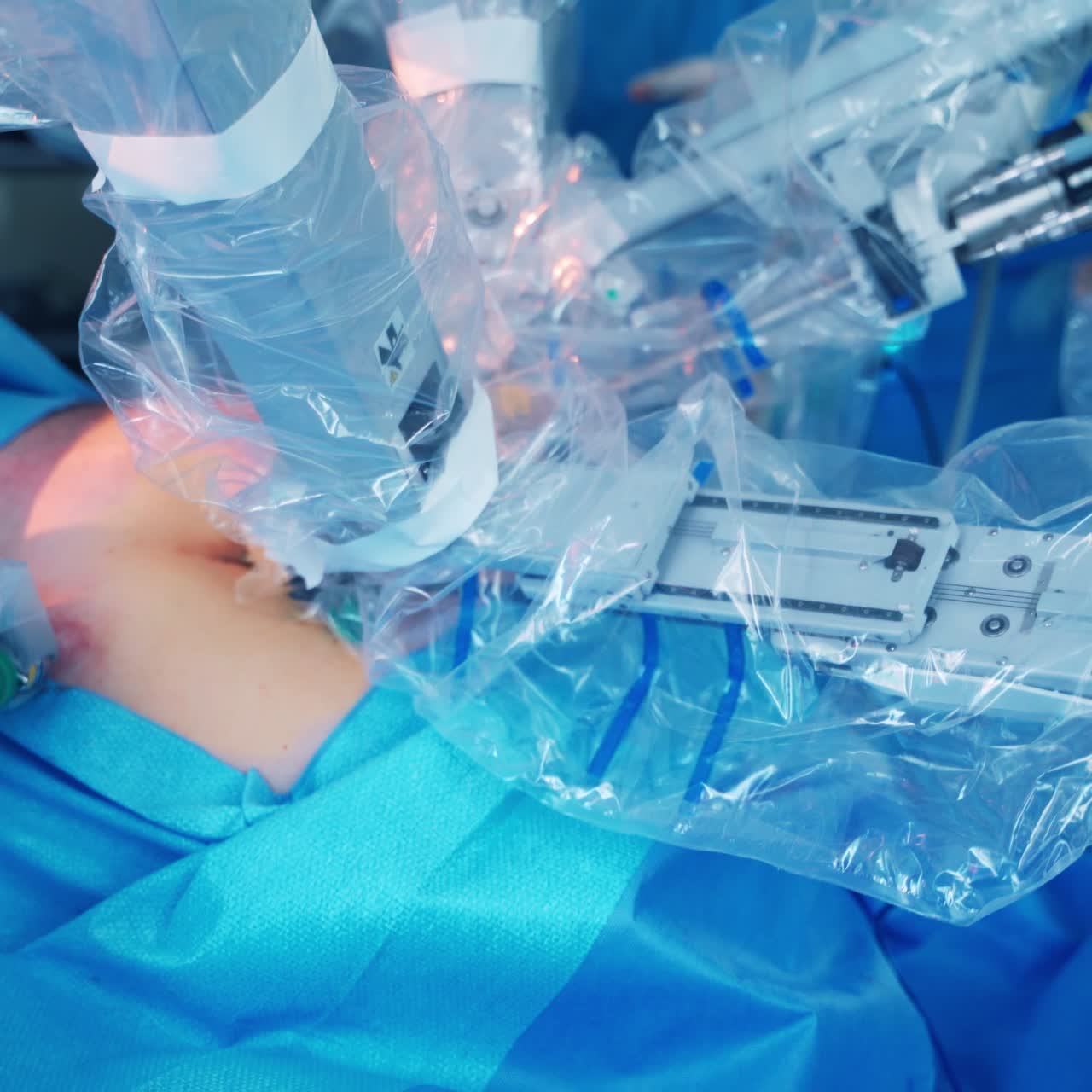 Da Vinci Surgical System. New technologies in surgery. Minimally invasive robotic surgery.