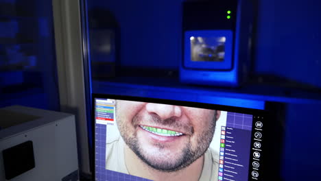 process of manufacturing dentures in dental lab. dental technician looking at scan of prosthesis on computer screen