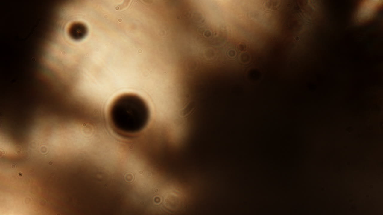 toma de primer plano de los flotadores oculares que flotan en la superficie del ojo, borrando la visión