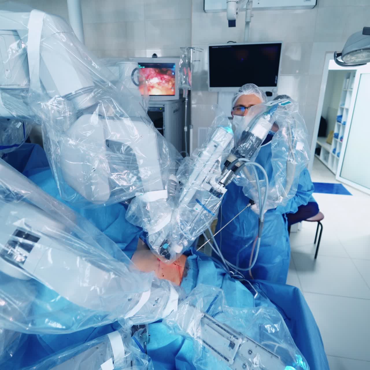 Robotic Surgery. Group of surgeons in operating room with surgery equipment. Future of Medicine