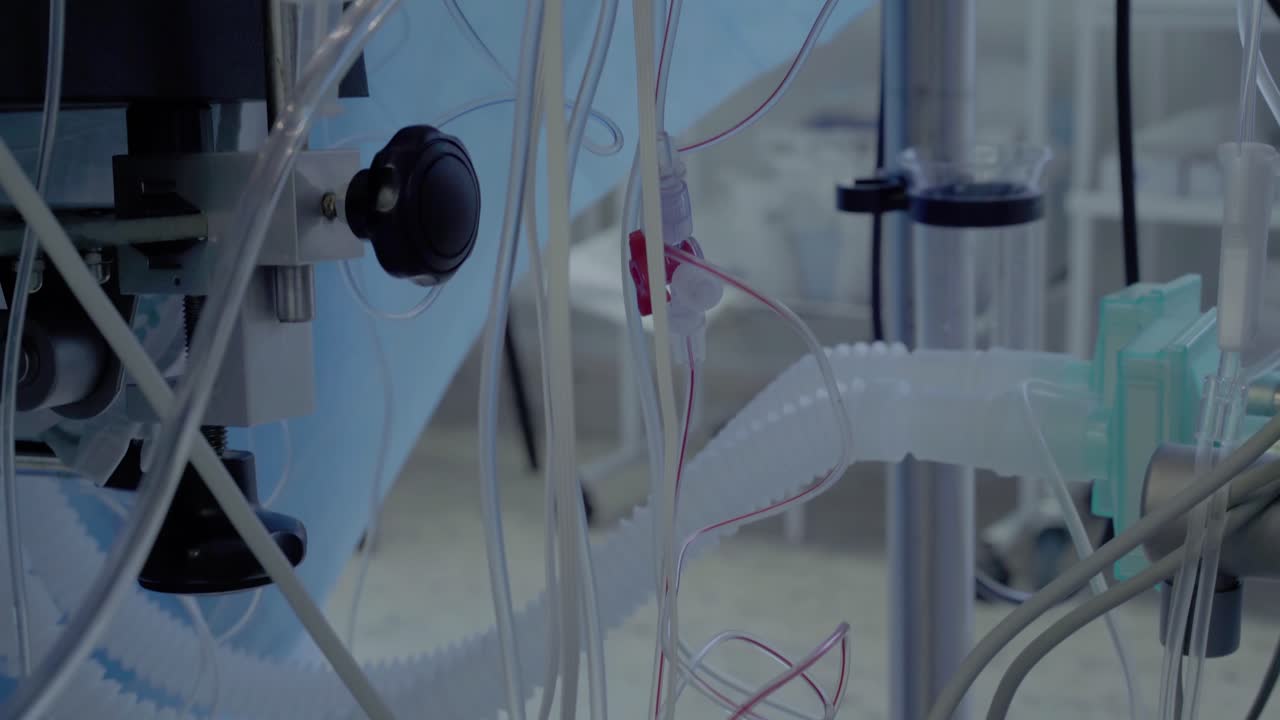 parte del equipo de la unidad operativa para la operación de maniobras aortocoronarias