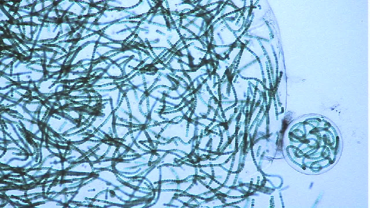 푸른 녹조류 2의 사슬을 포함하는 자루 또는 거품의 현미경 보기