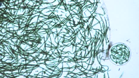 microscopic view of sacks or bubbles containing chains of blue green algae 2