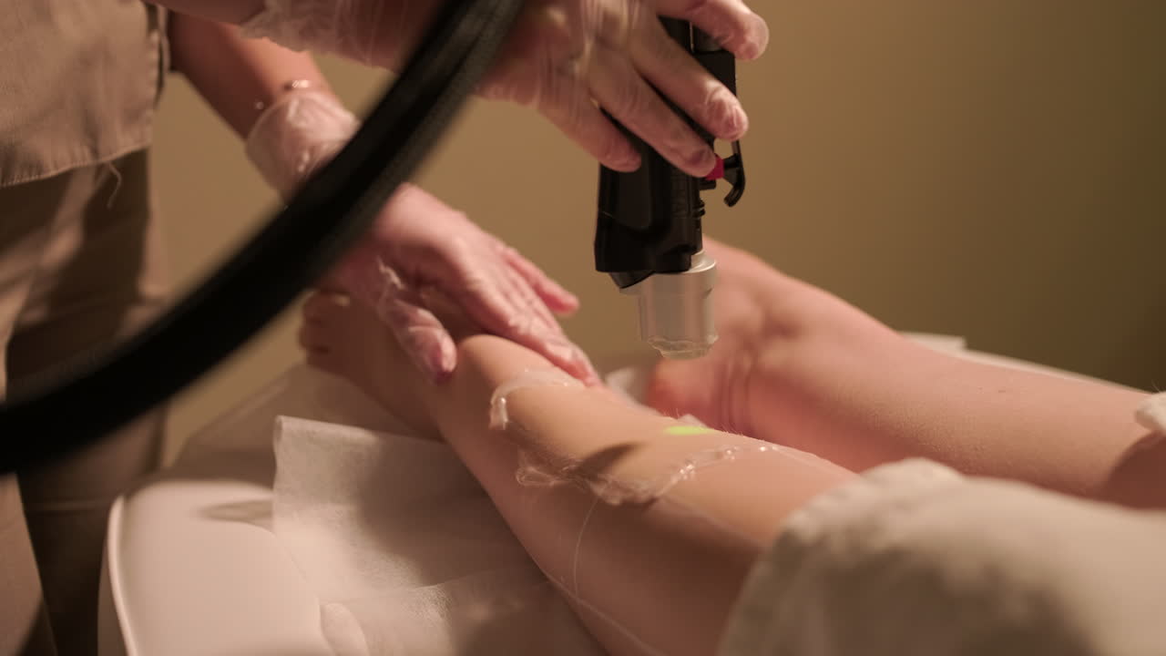 Professional Laser Hair Removal Treatment on a Woman's Leg