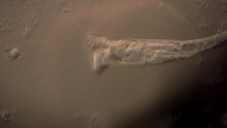 microscopic rotifers feed and move about