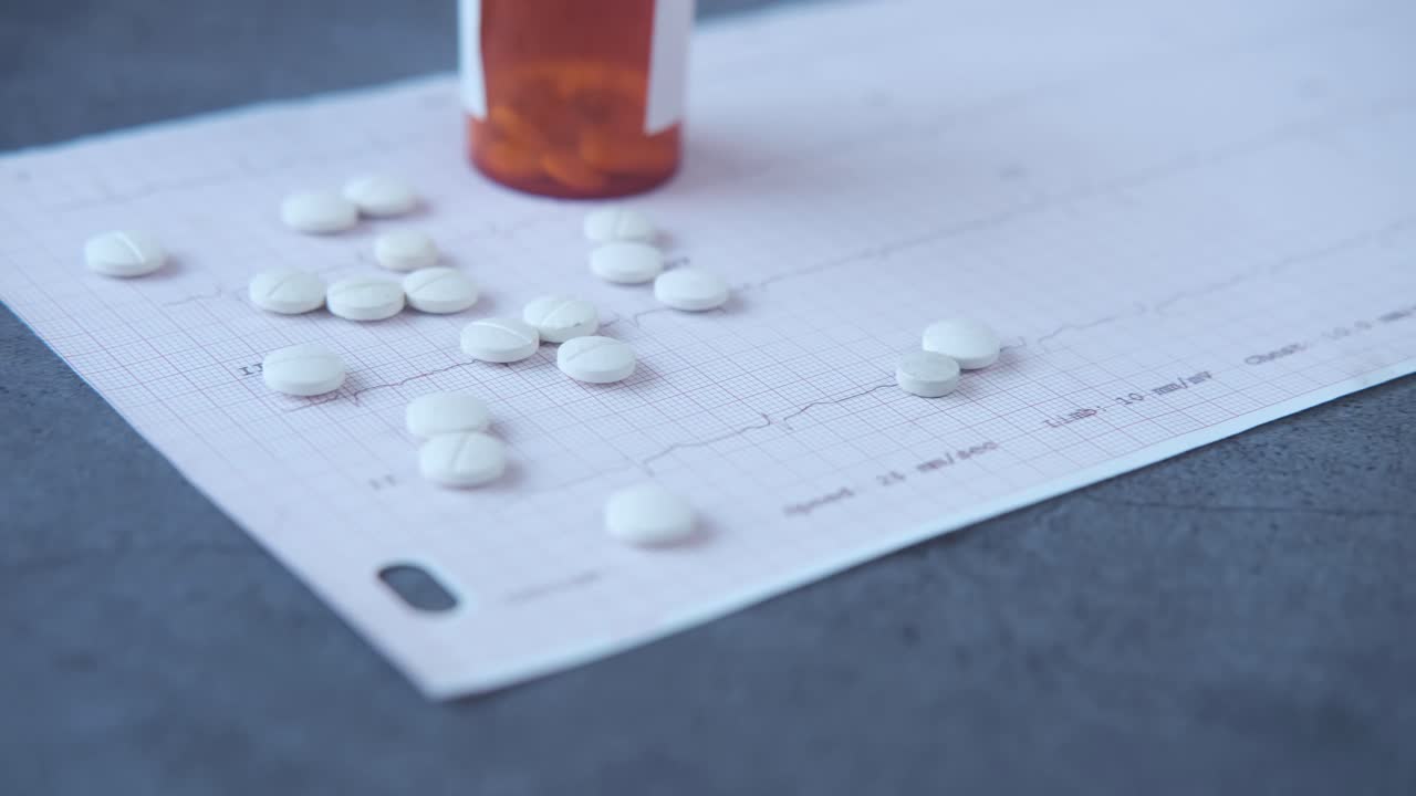 ecg 그래프에 대한 약물