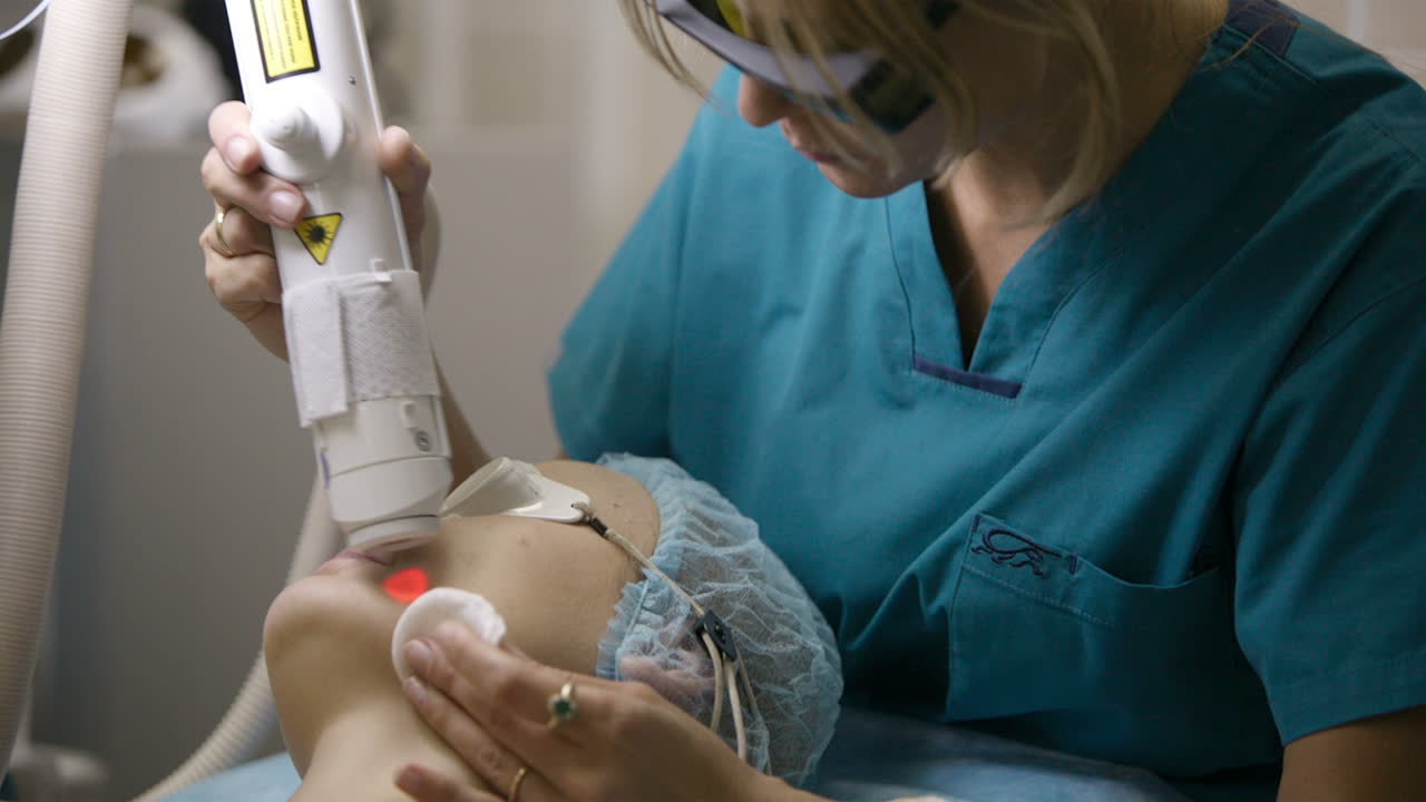 Procedura estetica con il laser