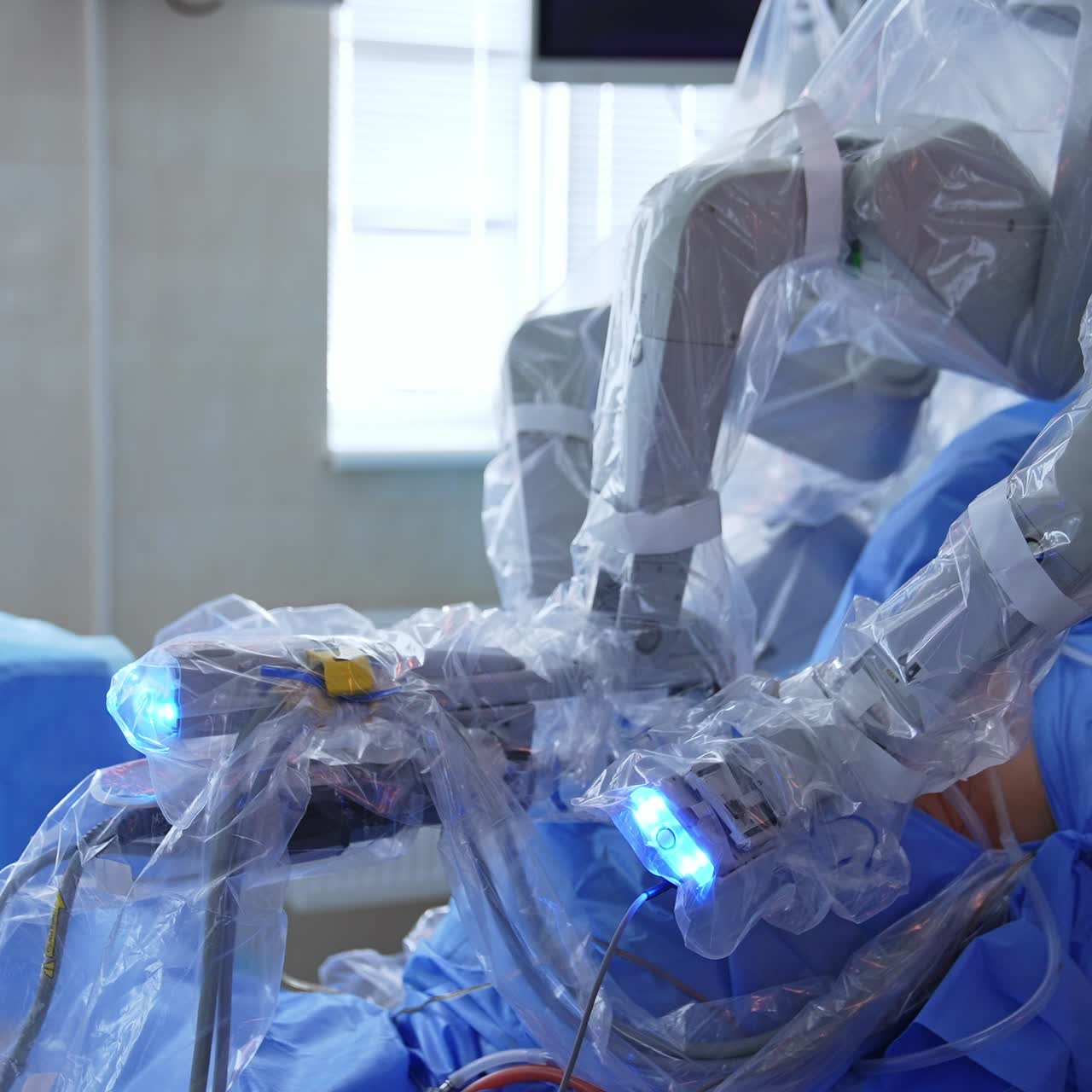 Patient on the table being operated by the innovative robotic equipment. Futuristic technologies in modern surgery theatre