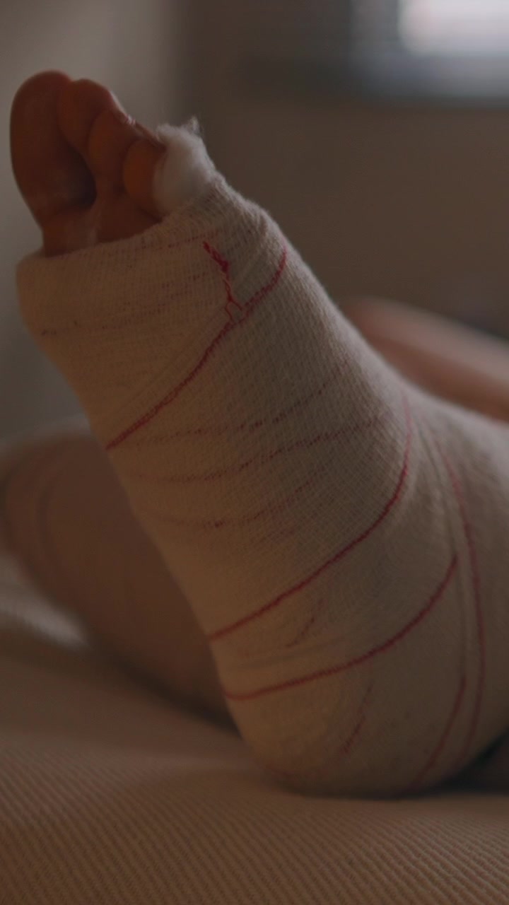 Homme se reposant au lit avec un plâtre sur son pied blessé