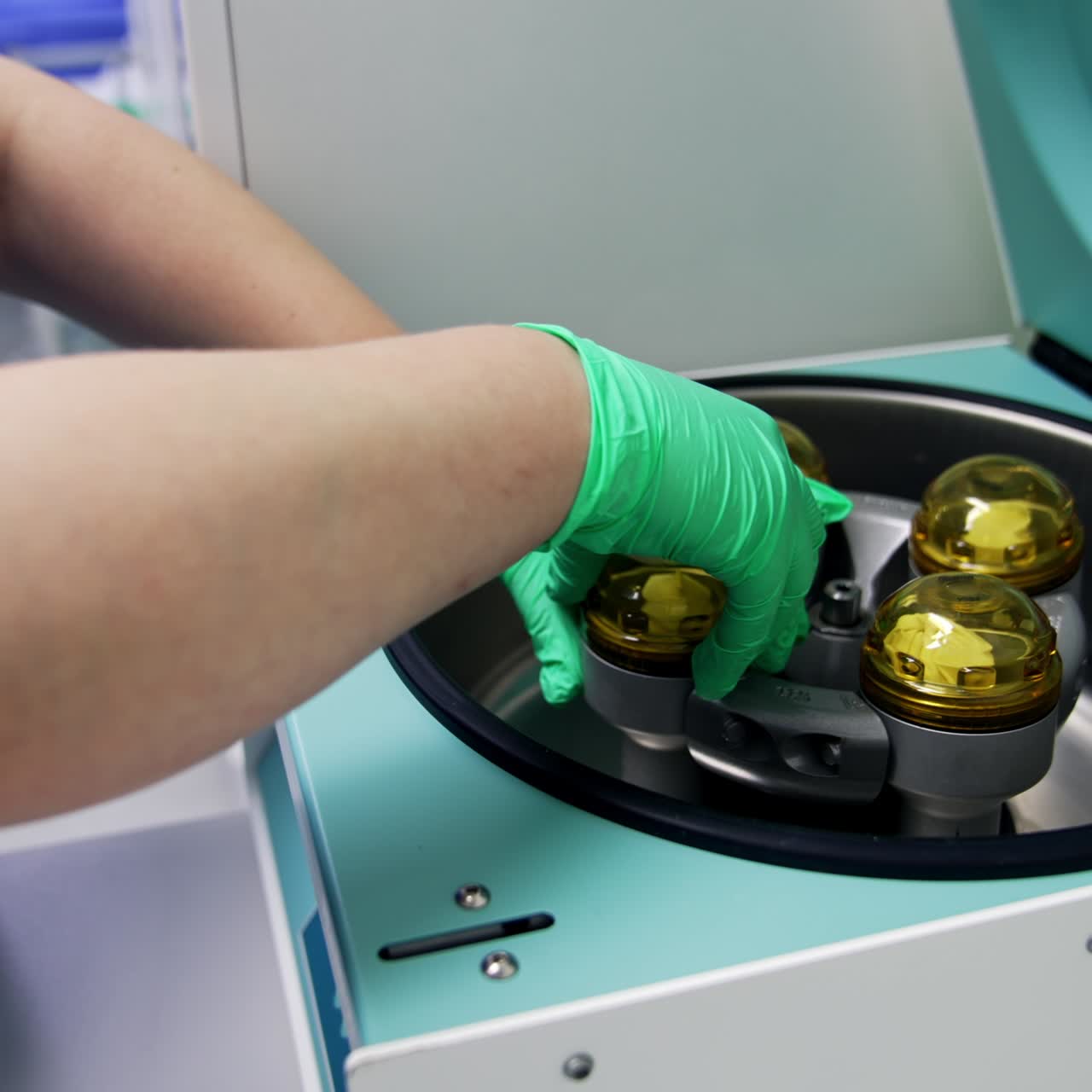 Nurse's hands in latex gloves open the lid of centrifuge system. Medic unscrews the cover and extracts the sample of blood plasma. Close up