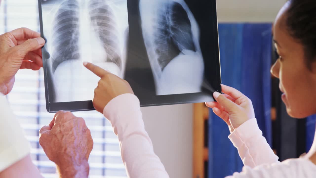 생리치료사와 고령자가  ⁇ 스레이 4k를 통해 토론하고 있습니다.