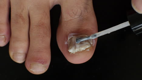 macro shot of a big toe being painted with anti-fungal treatment on a shiny black background.