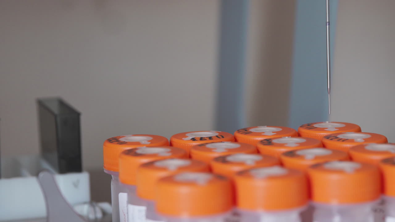 의료 센터에서, 기계는  ⁇ 는 환자의 암 세포의 존재에 대한 바이오 물질을 분석합니다.