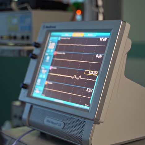 screen showing curve of patient's heartbeat. equipment monitoring the condition of patient's heart. close up