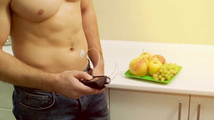Uomo diabetico con una pompa per insulina collegata all'addome e che tiene la pompa per insulina tra le mani. Concetto di diabete