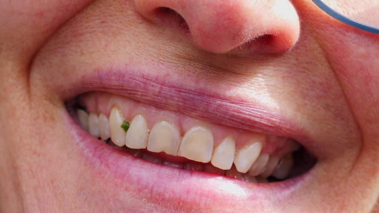 Extreme close-up of a smiling woman with a small piece of lettuce stuck between her front teeth, illustrating an awkward everyday moment and dental hygiene concept.