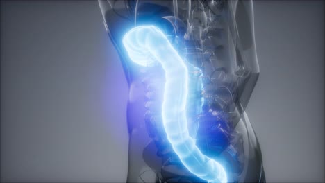 examen de radiología del colon humano