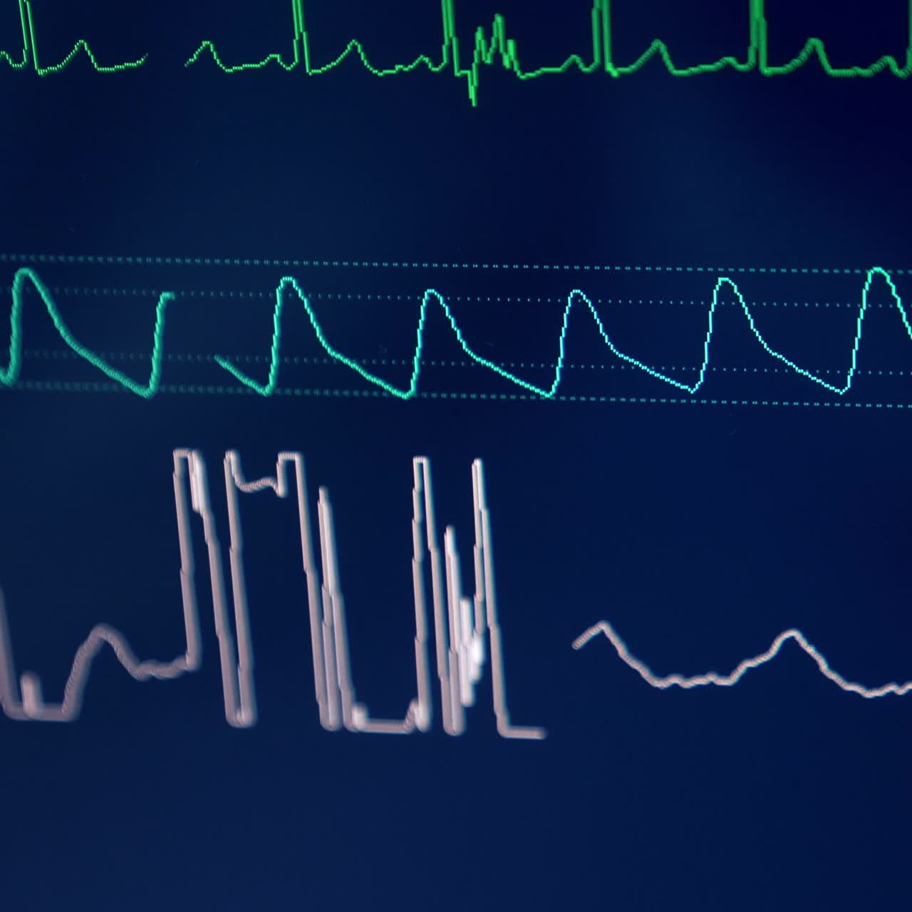 Three diverse curves running at the screen of equipment. Patient's life signs at operation. Close up