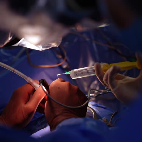 hands of unrecognized surgeon wearing latex gloves perform operation. assistant pours the medicines from syringe on the operational spot.