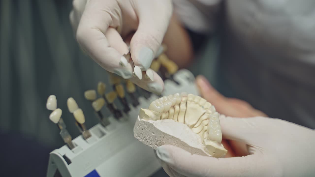 Female hands in white gloves choosing the right color of a tooth to a dental model of jaw. Teeth model in the hands of a professional dentist. Close-up