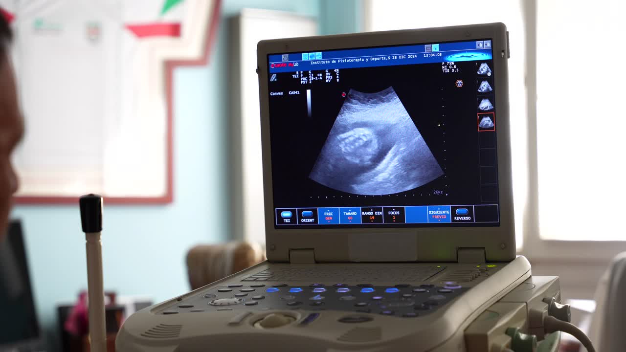 Ultrasound scanner machine showing a baby backbone on the screen. Close up