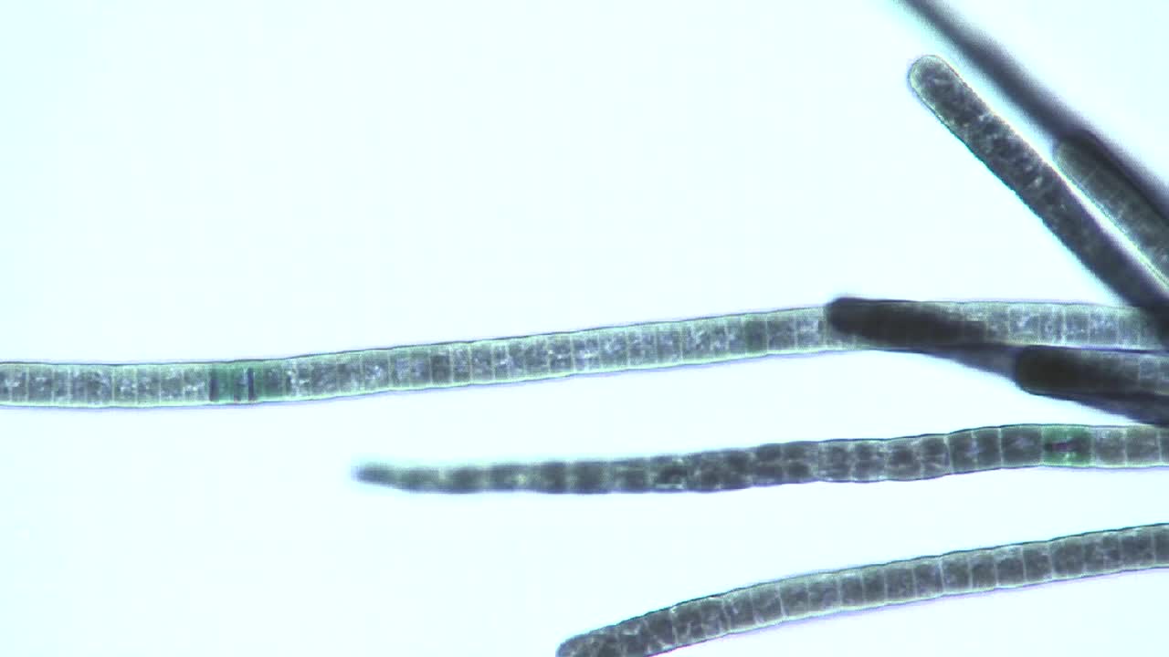 포르미디움 남조류 2의 현미경 사진