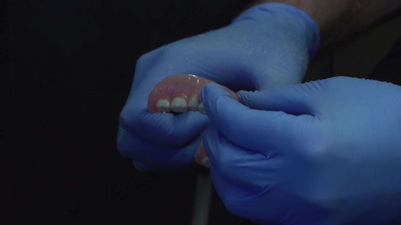 Trimming implant retained dentures for fitting. This is a dental procedure done for a patient who has replaced teeth.