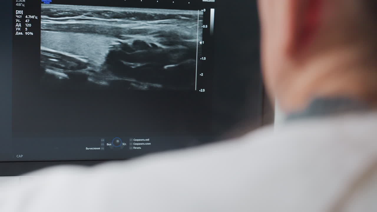 Close up of imaging machine displaying internal body structures in real-time during medical scan, as medical professional examines and monitors diagnostic results on high-resolution ultrasound screen
