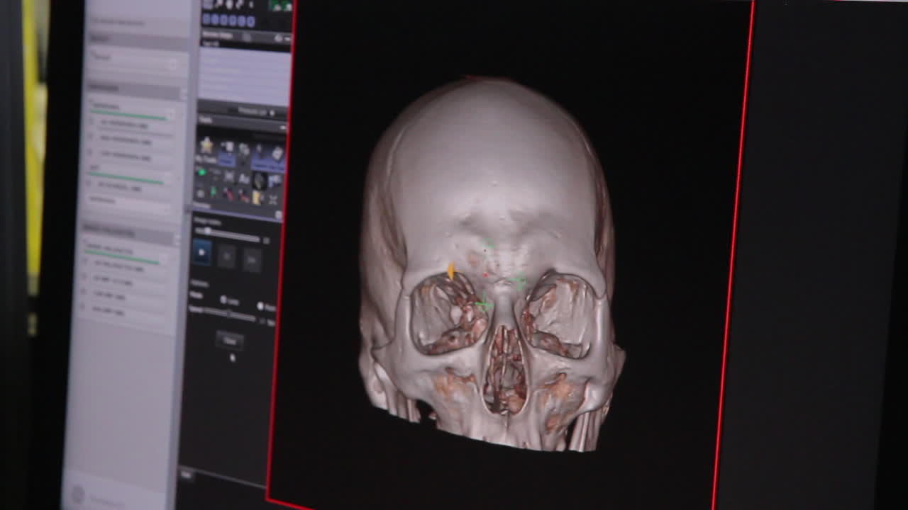CT body scan