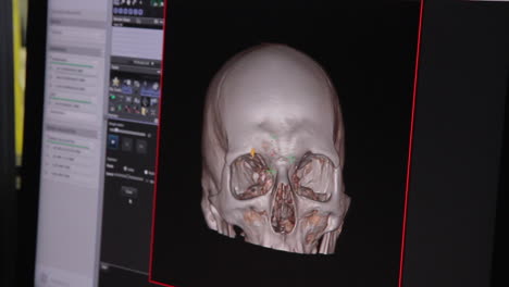 Tomografía-Computarizada-Del-Cuerpo