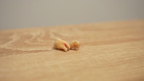 detailed shot of two freshly extracted wisdom teeth with dry blood