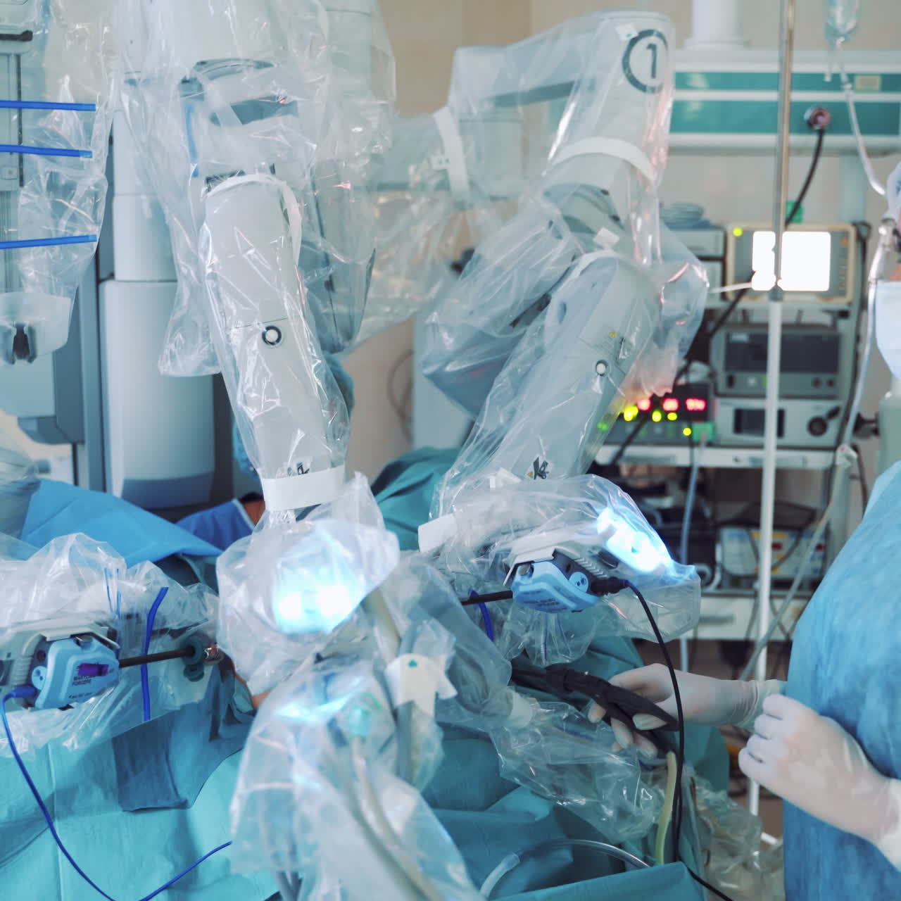 Modern surgical system. Medical robot. Minimally invasive robotic surgery.