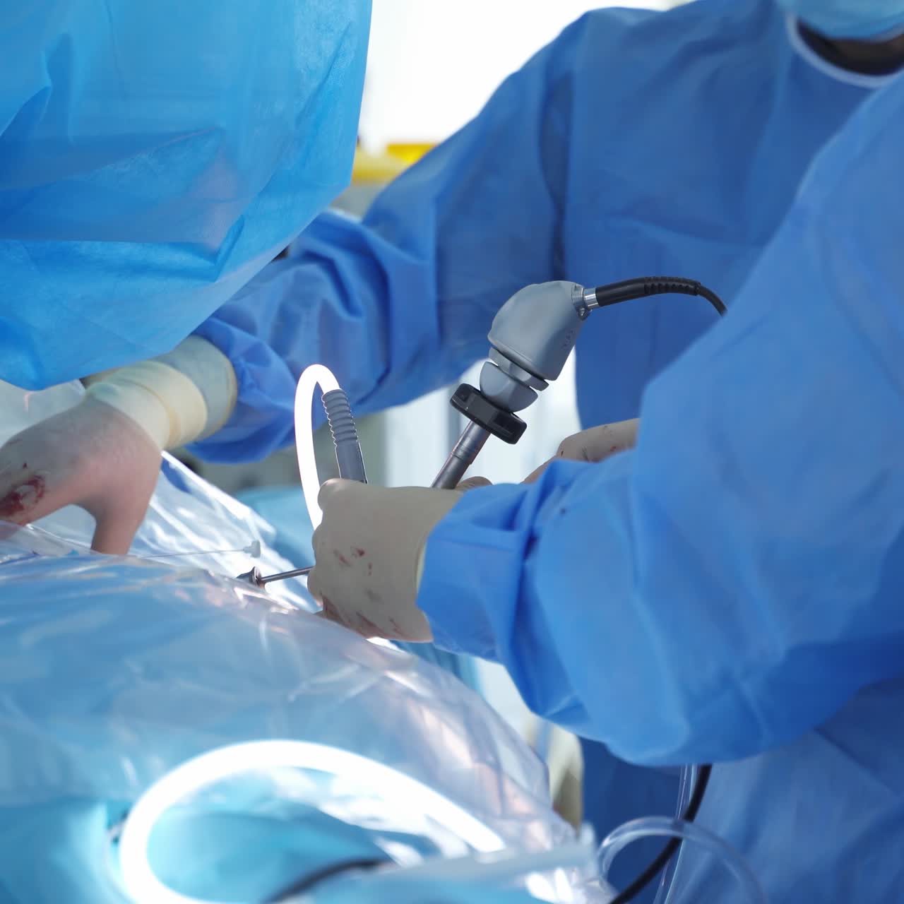 Group of doctors perform an operation to a patient. Surgeons in medical uniform and masks working in the operating room
