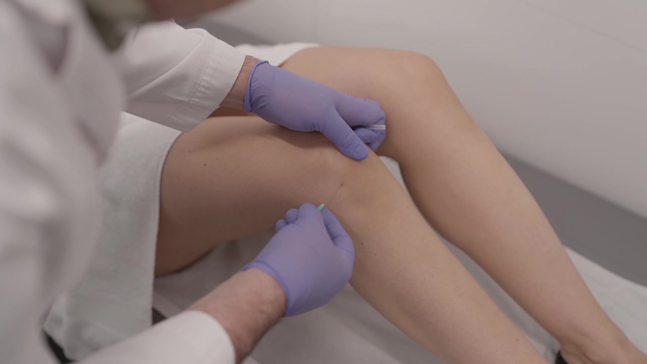 Una terapista professionista in camice bianco e guanti blu esegue dry needling o agopuntura sul ginocchio di una donna per il sollievo dal dolore e il benessere