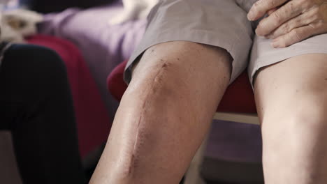 scar on a knee after surgery
