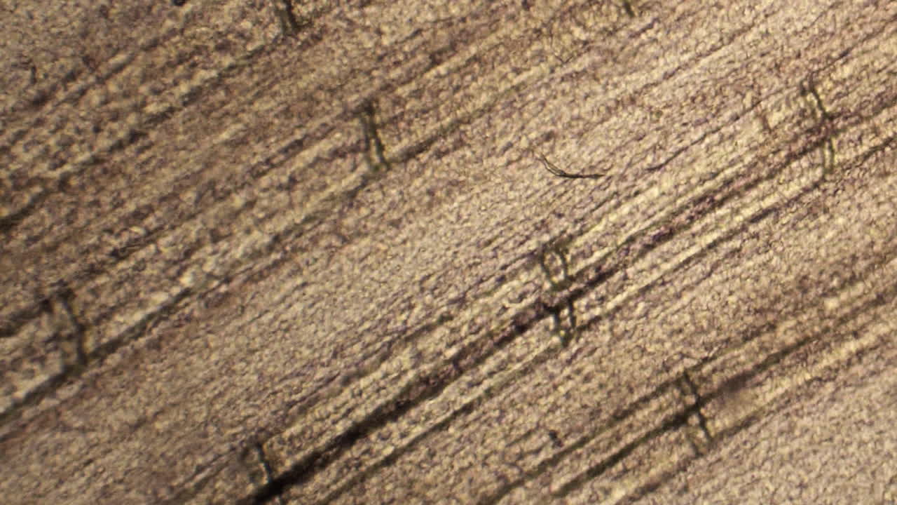 las células sanguíneas se mueven en fila india a través de los capilares