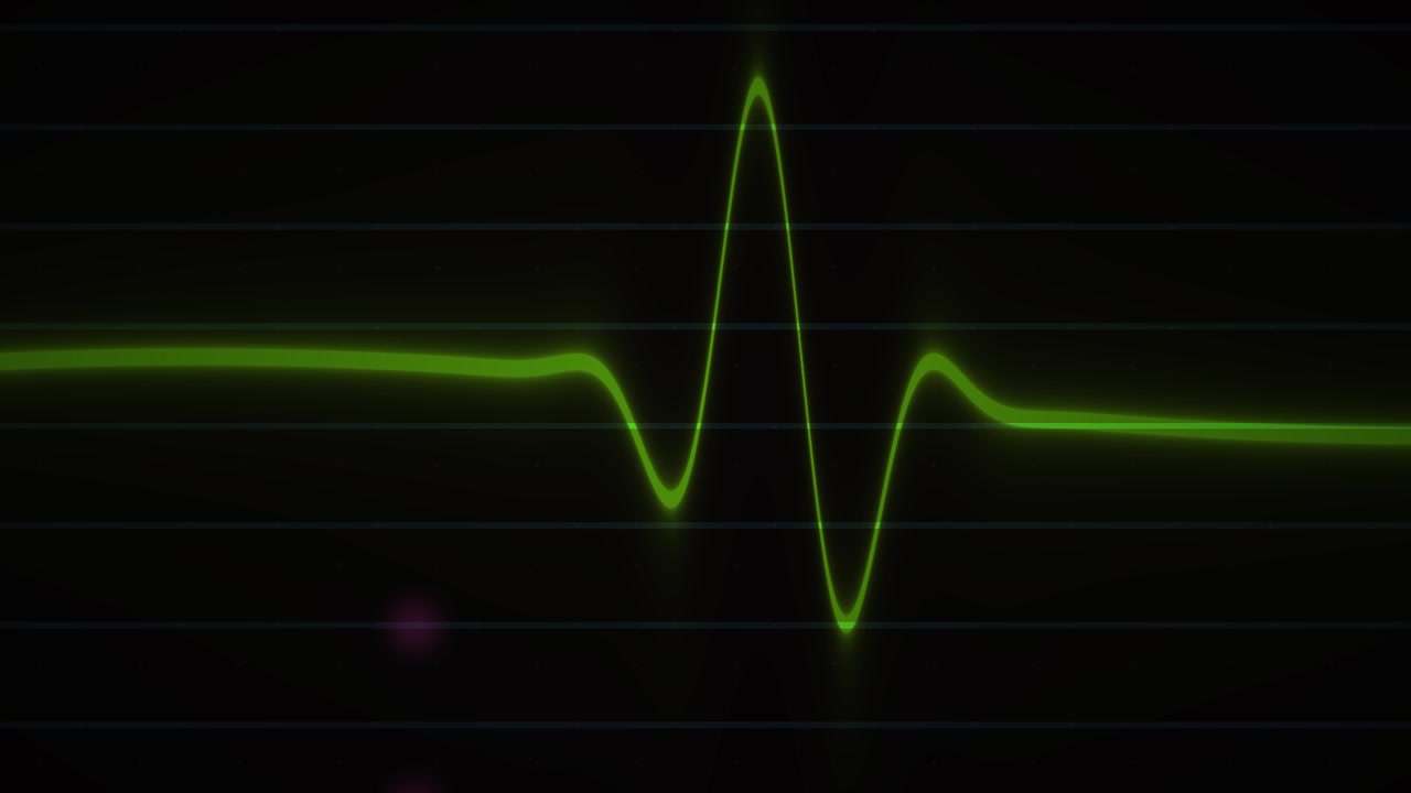 Pulso de Latido Verde en Pantalla de Monitor ECG