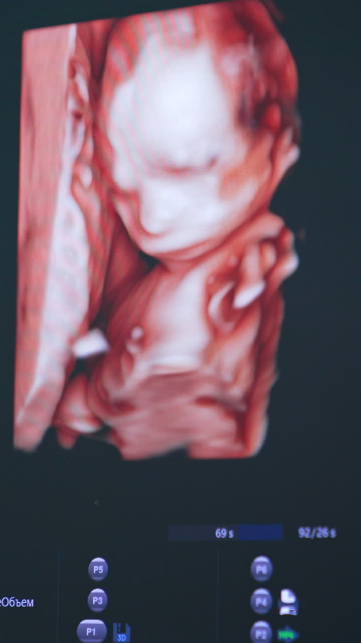 Little unborn baby image moving on the monitor of ultrasonic equipment. Close up. Pregnancy examination. Vertical video