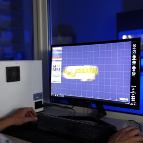 manufacturing of dental crowns