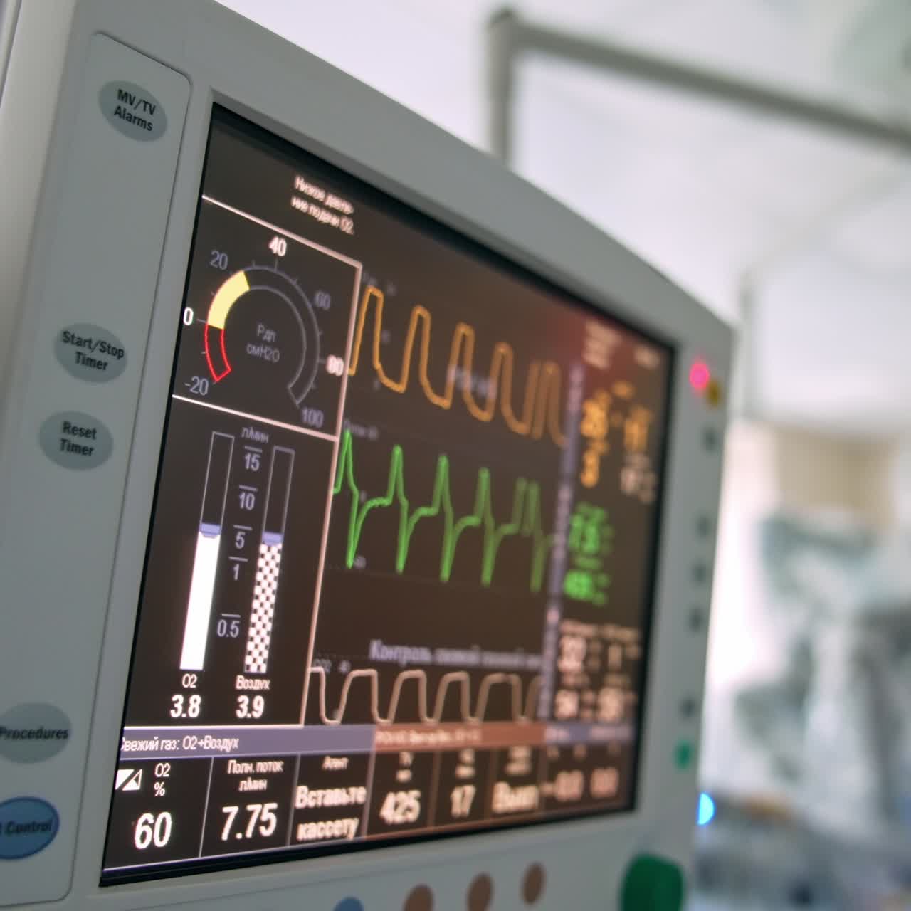 Black screen with colorful lines and numbers. Modern equipment working in surgery room during operation. Close up