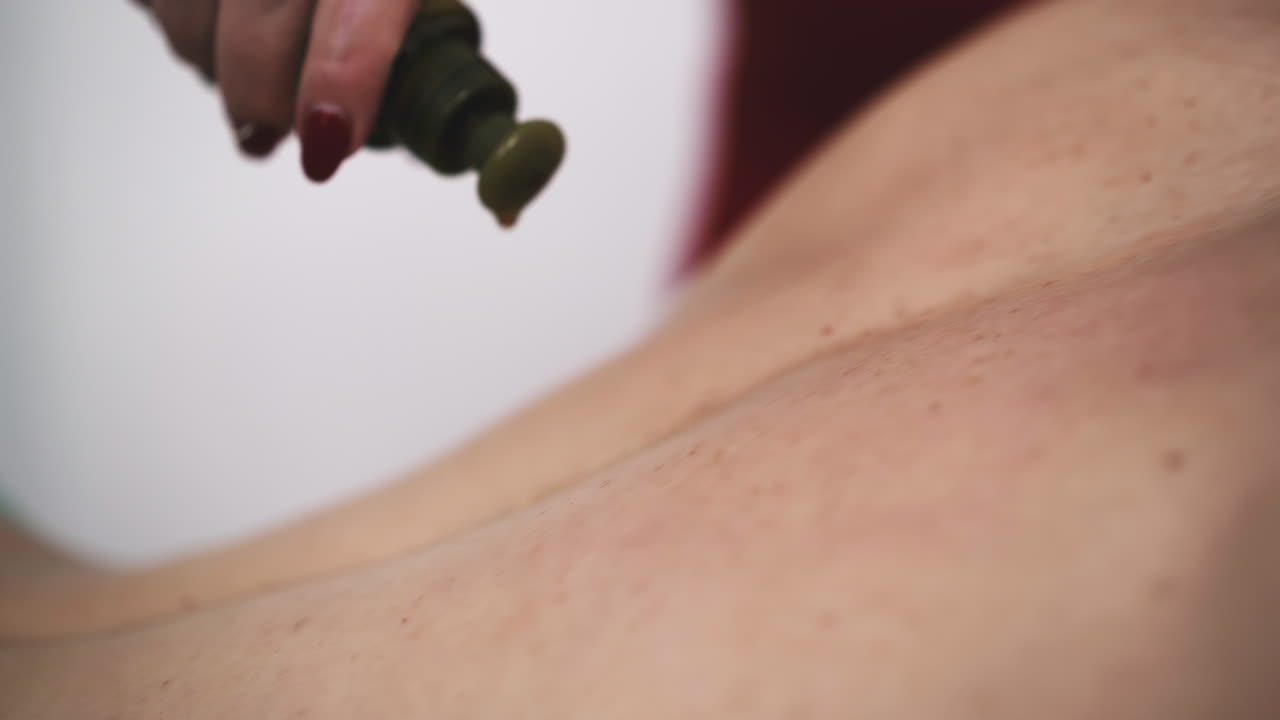 выливание масла для массажа на обнаженную спину пациентки в клинике