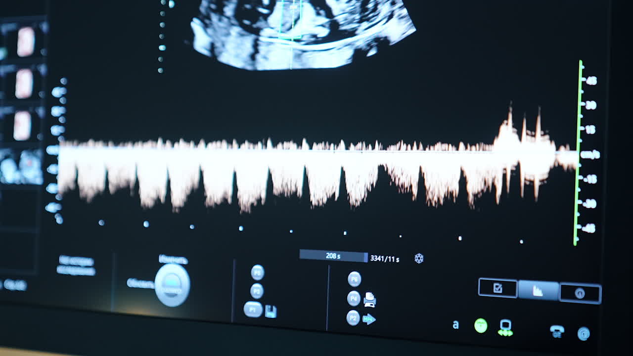 Screen of ultrasonic machine at work. Image of baby and life parameters on the monitor. Sonography of pregnant.